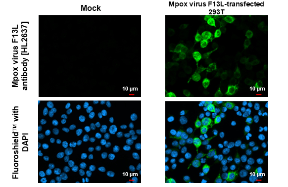 Anti-Mpox virus F13L antibody [HL2637] (GTX639093) | GeneTex